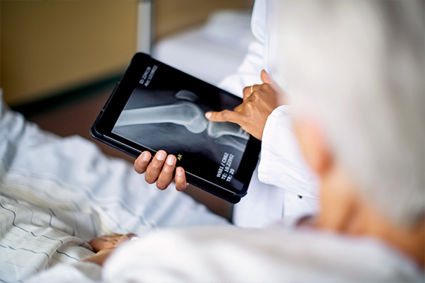 closeup of an x-ray in the hands of a provider
